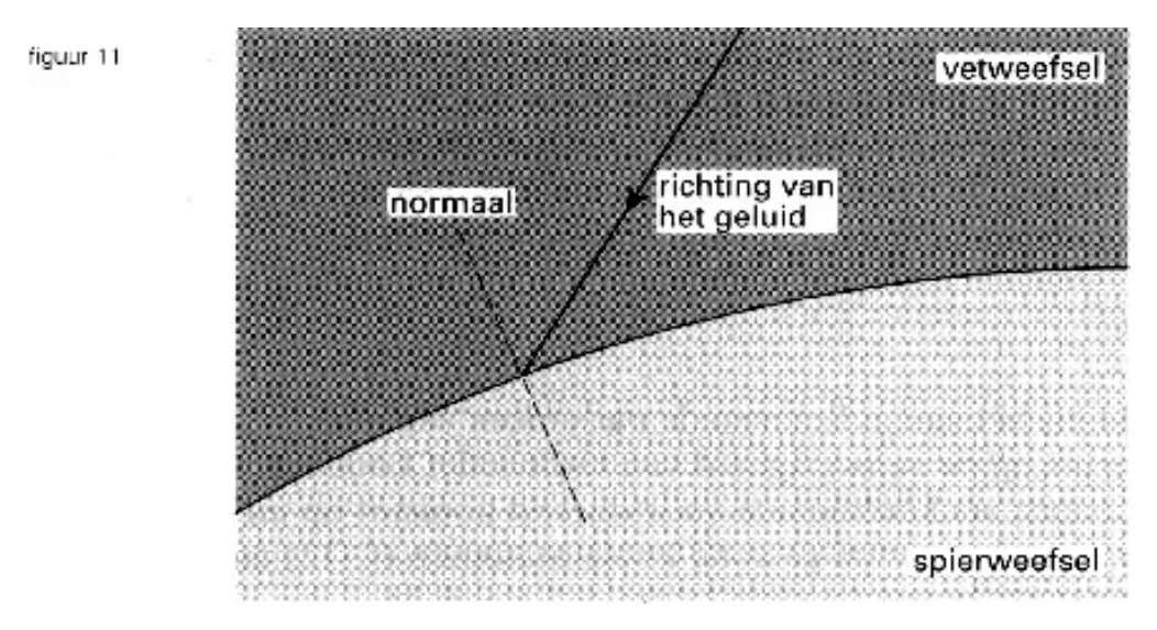 figuur bij de opgave