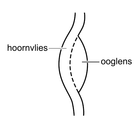 hoornvlies ooglens