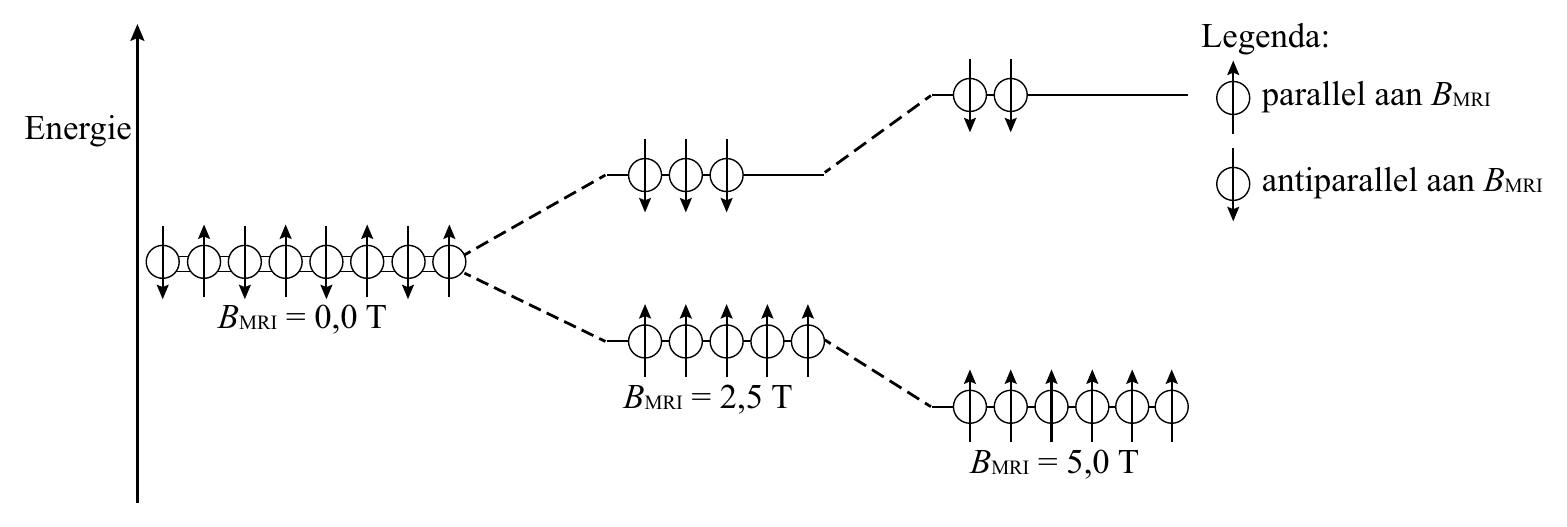 Legenda: parallel aan B MRI Energie antiparallel aan B MRI B = 0,0 T MRI B = 2,5 T MRI B = 5,0 T MRI